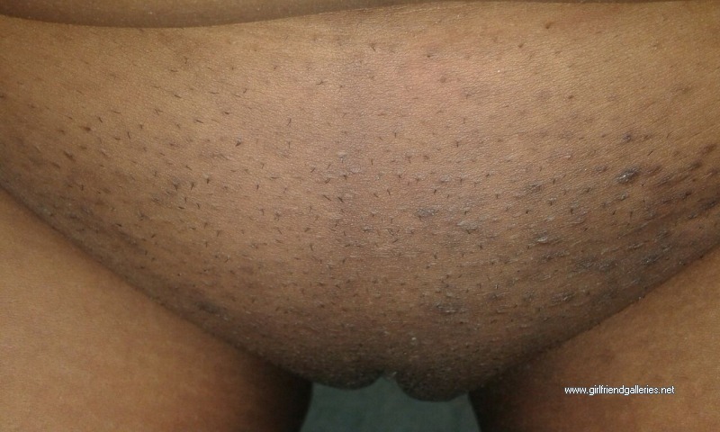 My Jamaican Friend Album2