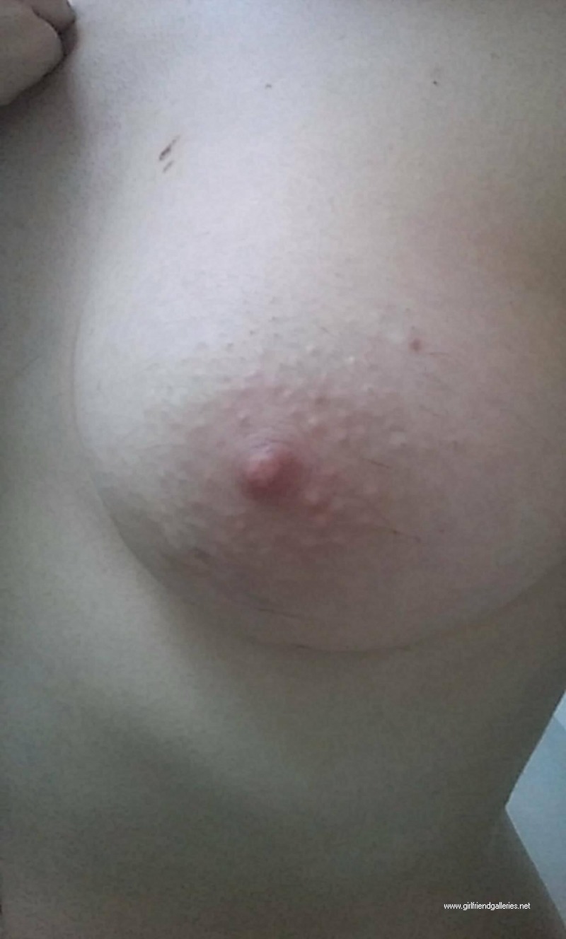 19yo