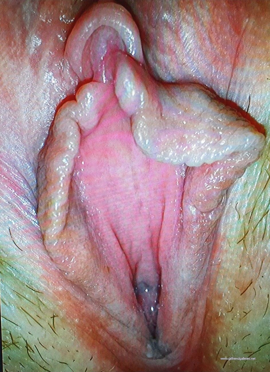 Pussy