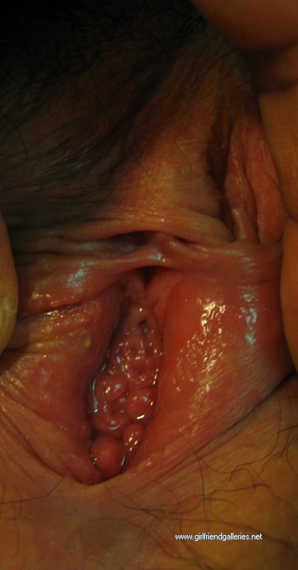 Close Up