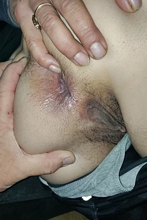 Asshole